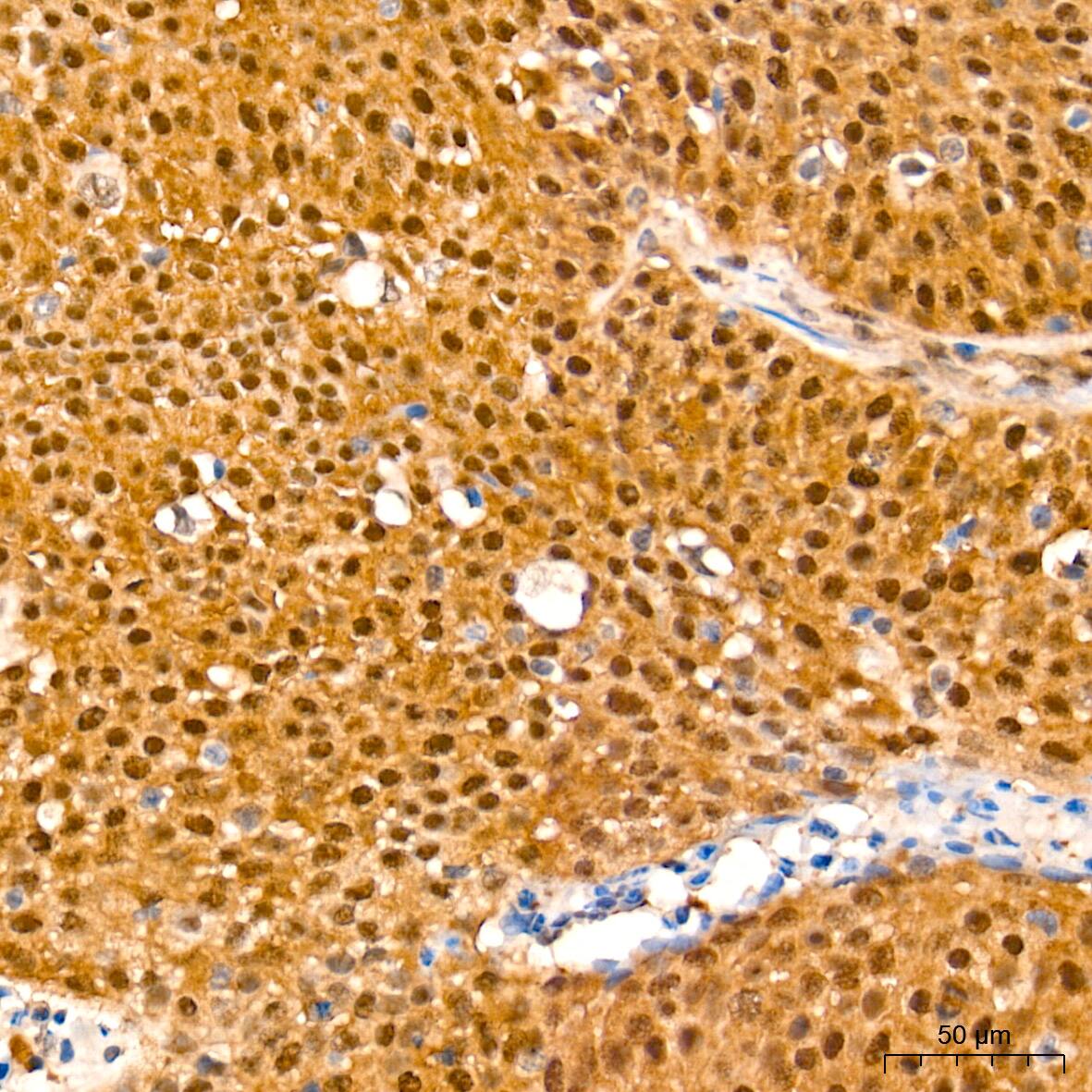 Smad4 Antibody (6B4D6)