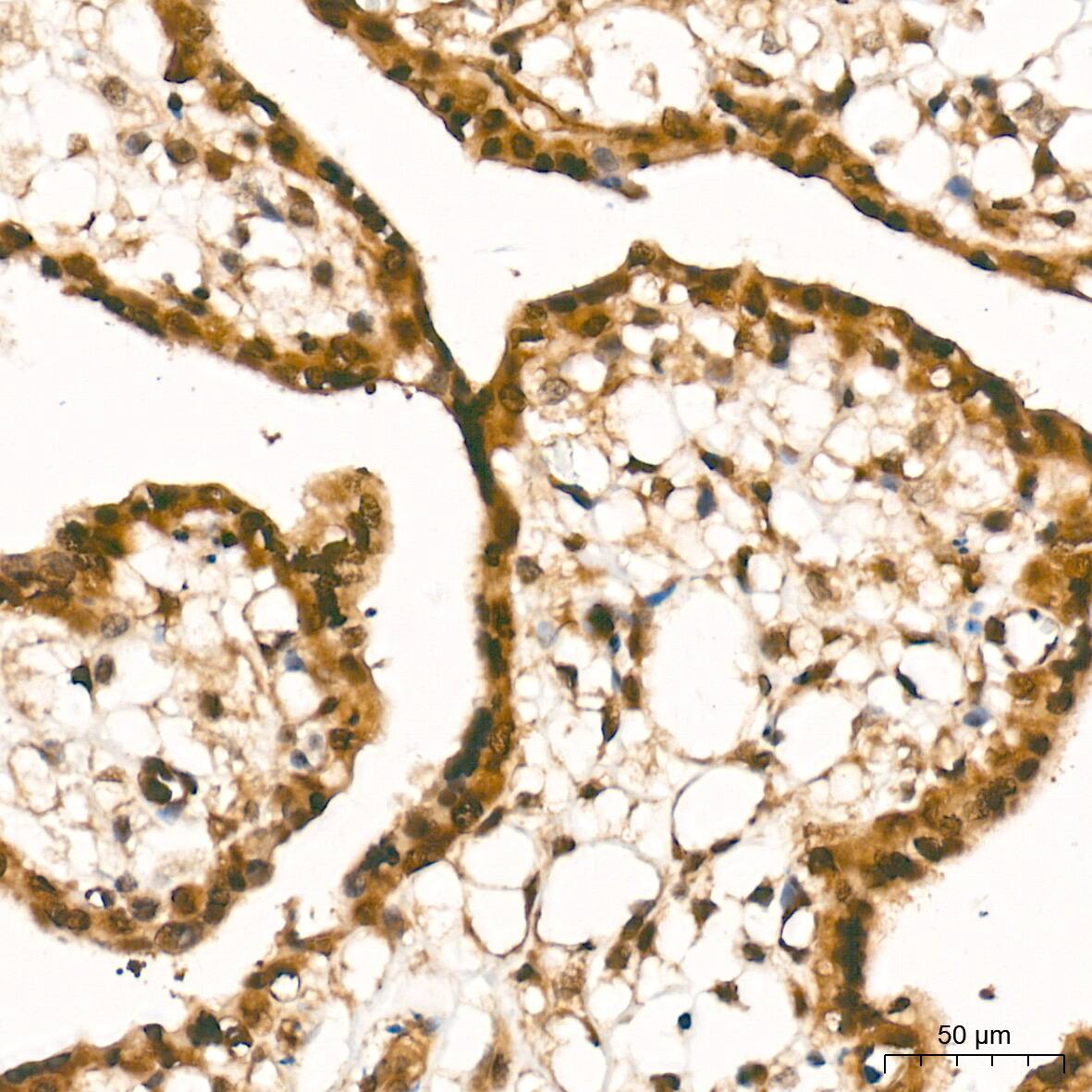 Smad4 Antibody (6B4D6)
