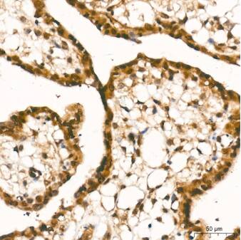 Smad4 Antibody (6B4D6)
