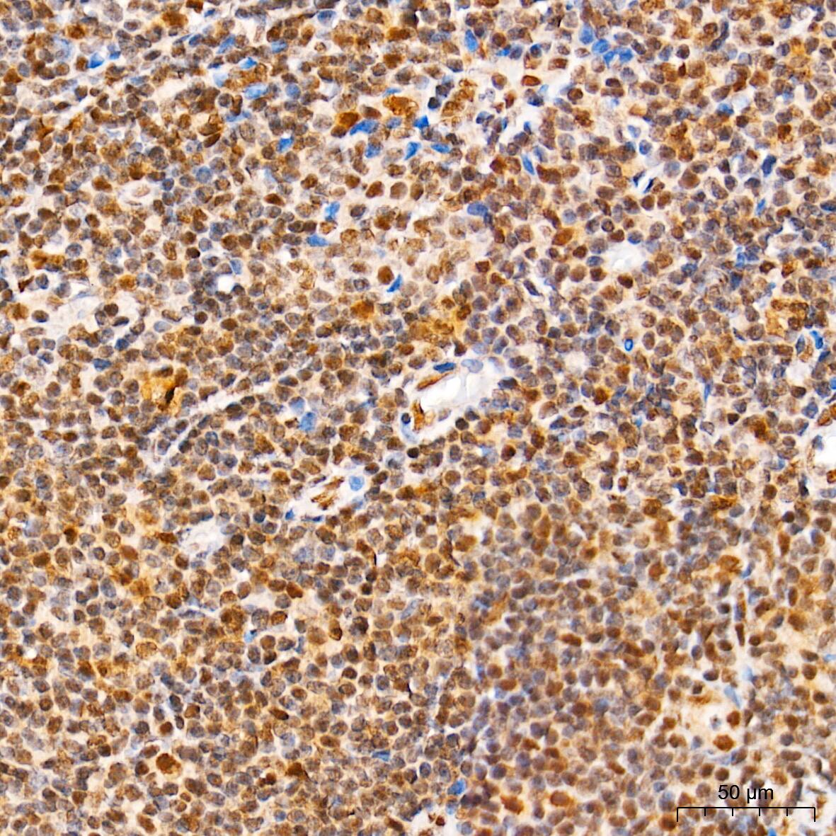 SUMO1 Antibody (6F8B6)