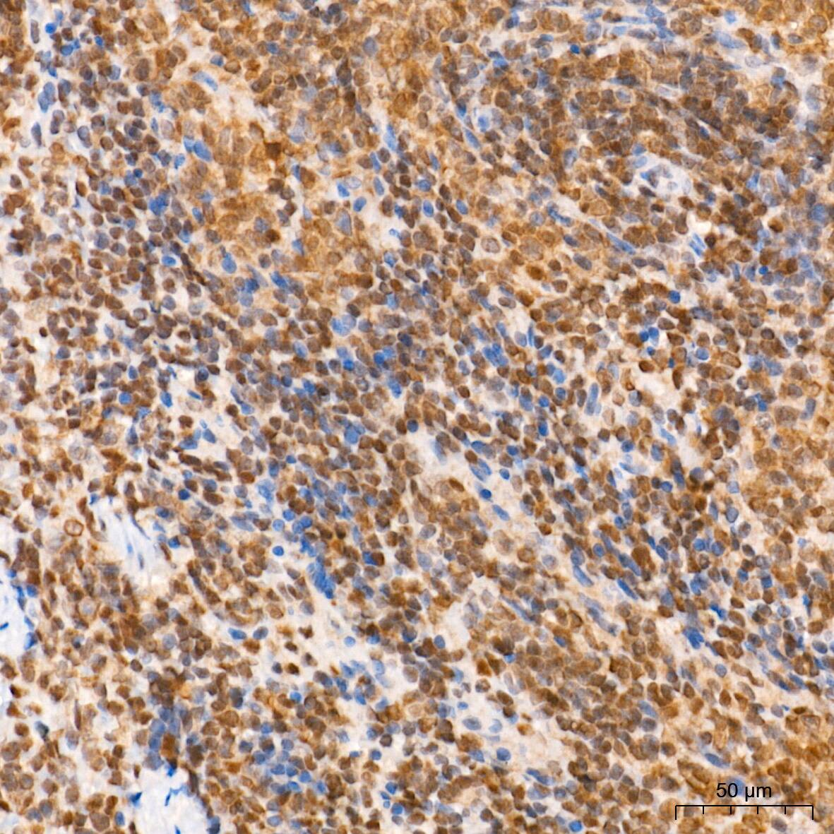 SUMO1 Antibody (6F8B6)