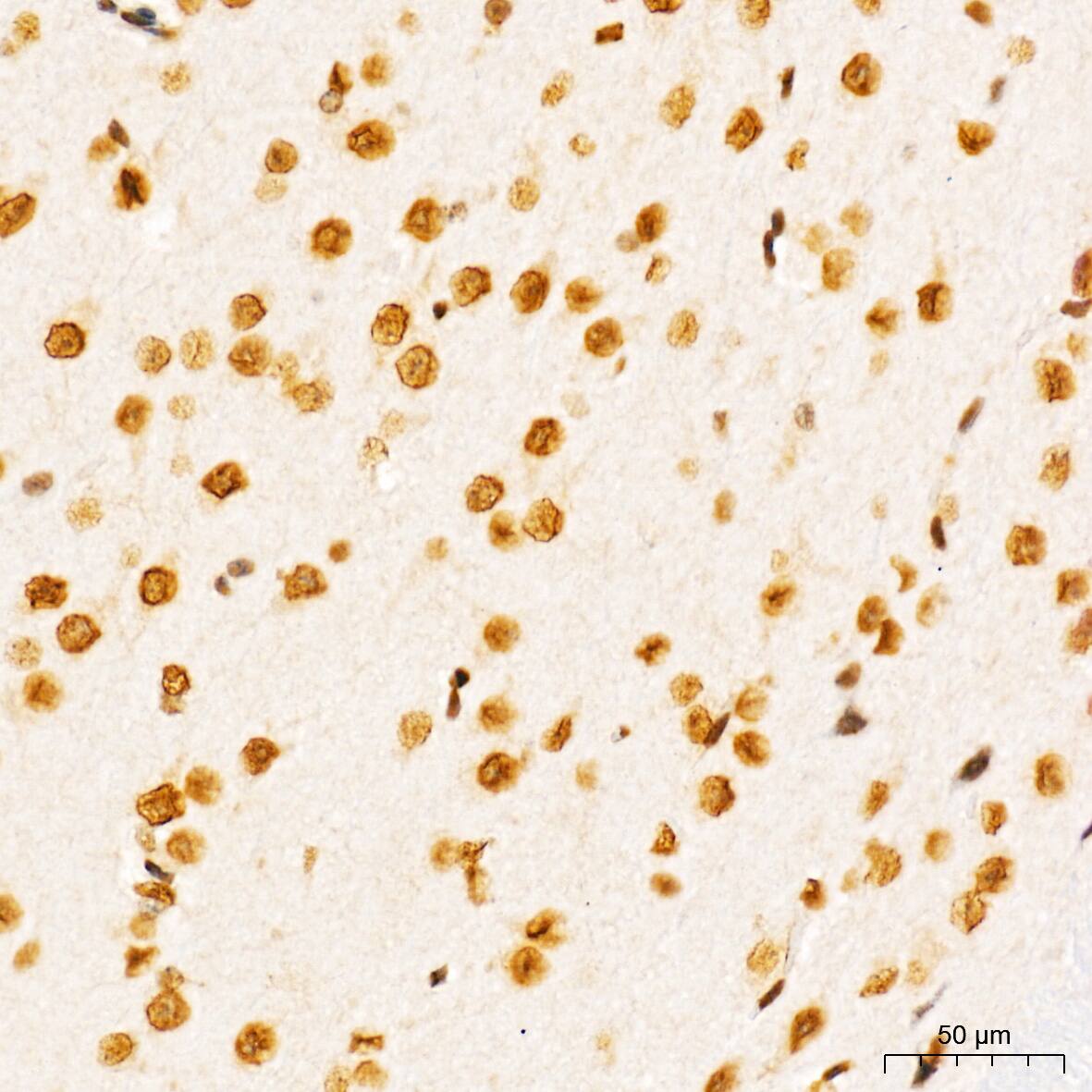 SUMO1 Antibody (6F8B6)