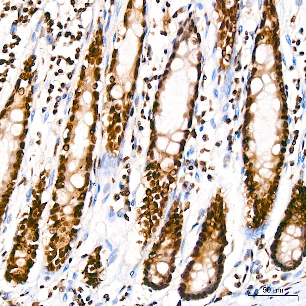 TDP-43/TARDBP Antibody (4R5L7)