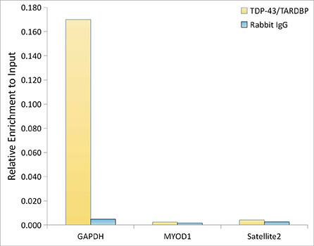 TDP-43/TARDBP Antibody (4R5L7)
