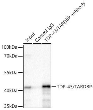 TDP-43/TARDBP Antibody (4R5L7)