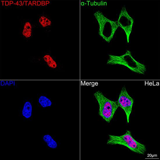 TDP-43/TARDBP Antibody (4R5L7)