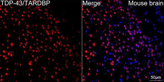 TDP-43/TARDBP Antibody (4R5L7)
