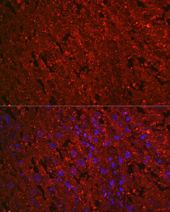 EG-VEGF/PK1 Antibody (1B4G2)
