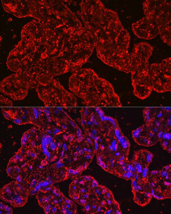 EG-VEGF/PK1 Antibody (1B4G2)