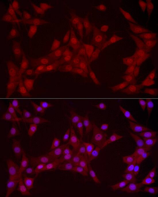 YAP1 Antibody (10G4S10)