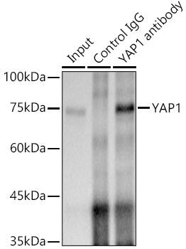 YAP1 Antibody (10G4S10)
