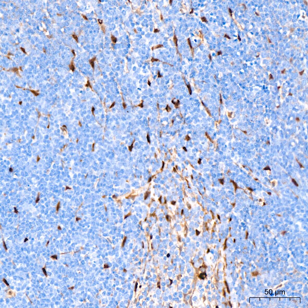YAP1 Antibody (10G4S10)