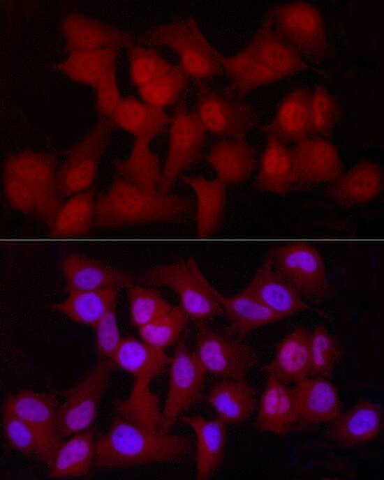 YAP1 Antibody (10G4S10)