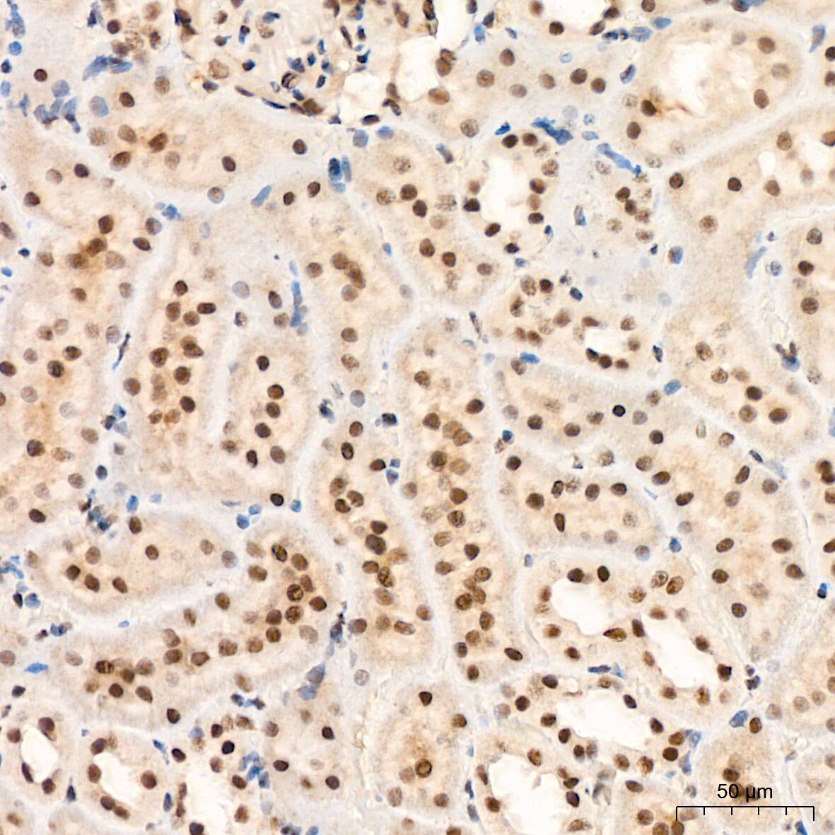 XPD Antibody (6T9K6)
