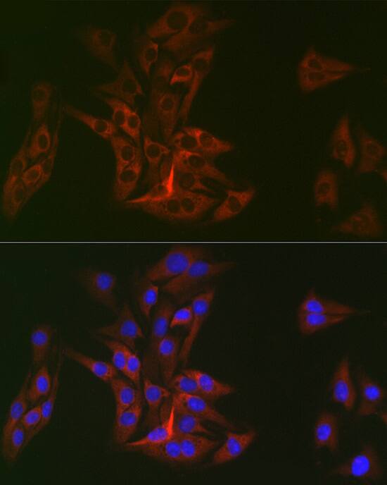 DOK1 Antibody (6U4U9)