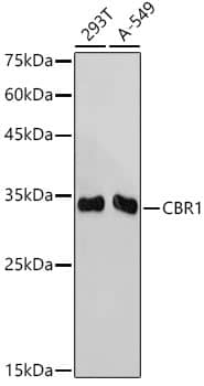 CBR1 Antibody (3A9O5)