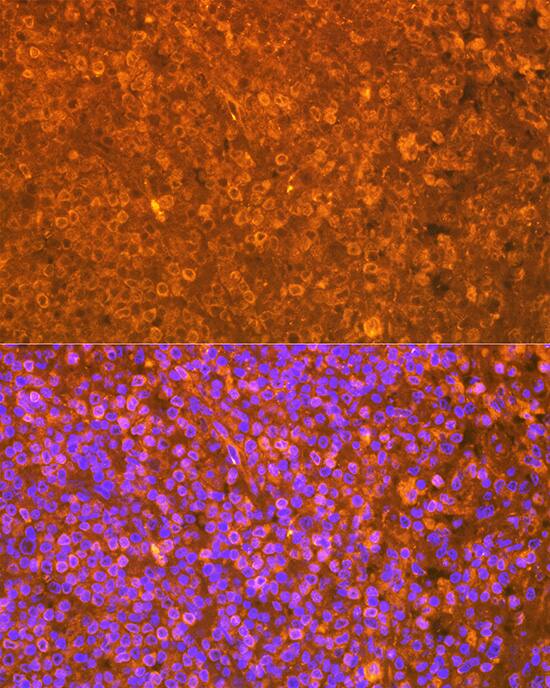 EBI3 Antibody (9J1H4)