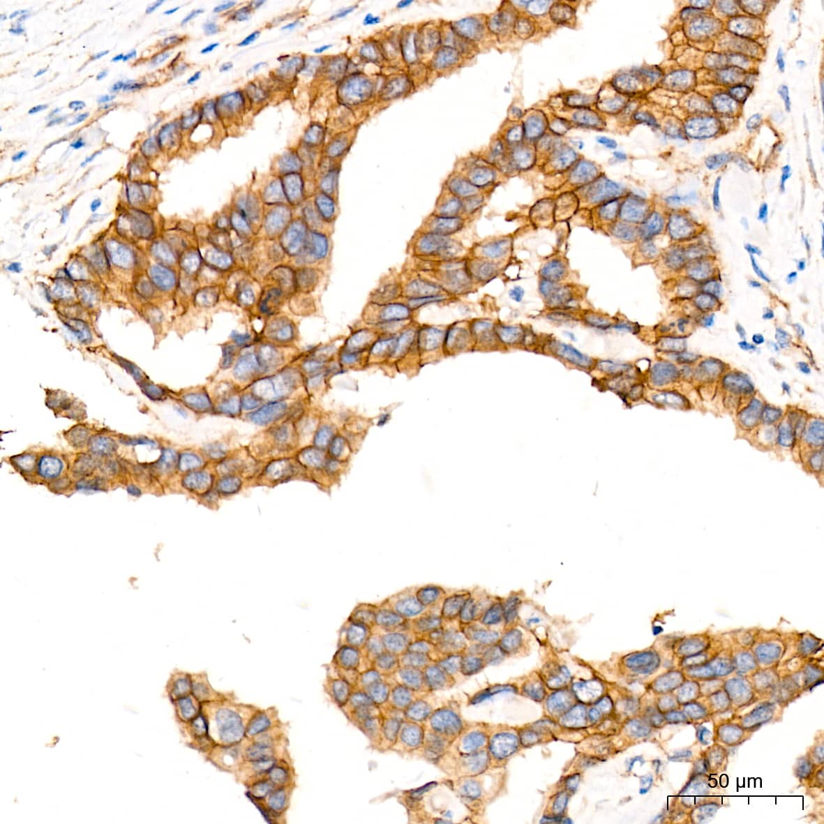 CTNNA3 Antibody (8F1U7)