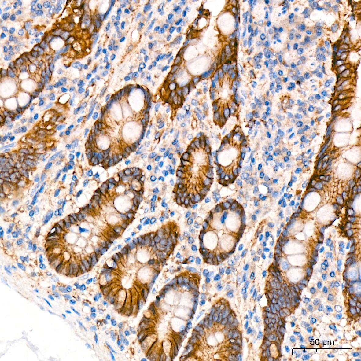 CTNNA3 Antibody (8F1U7)