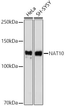 NAT10 Antibody (5Z3E5)