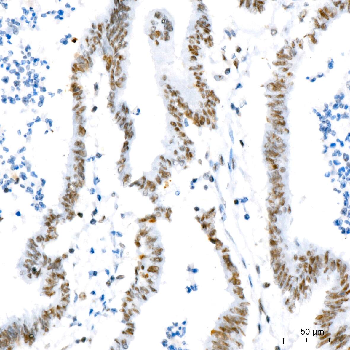 NAT10 Antibody (5Z3E5)
