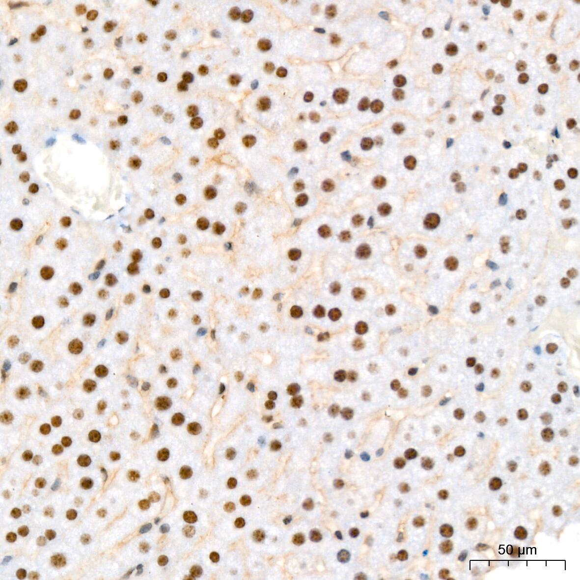 NAT10 Antibody (5Z3E5)