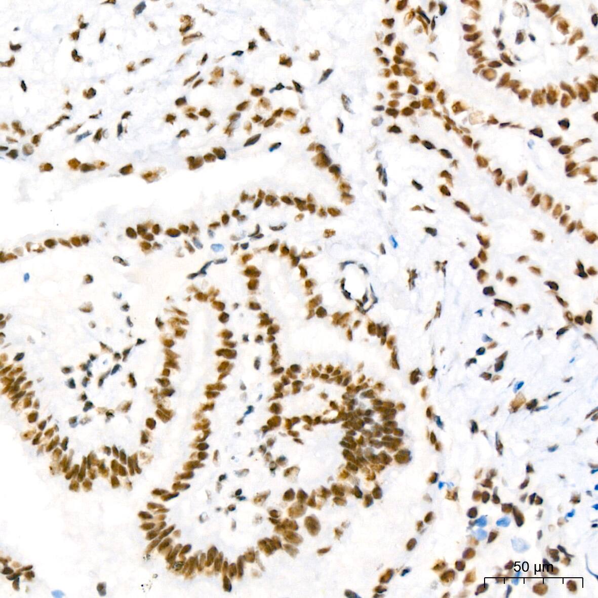 NAT10 Antibody (5Z3E5)