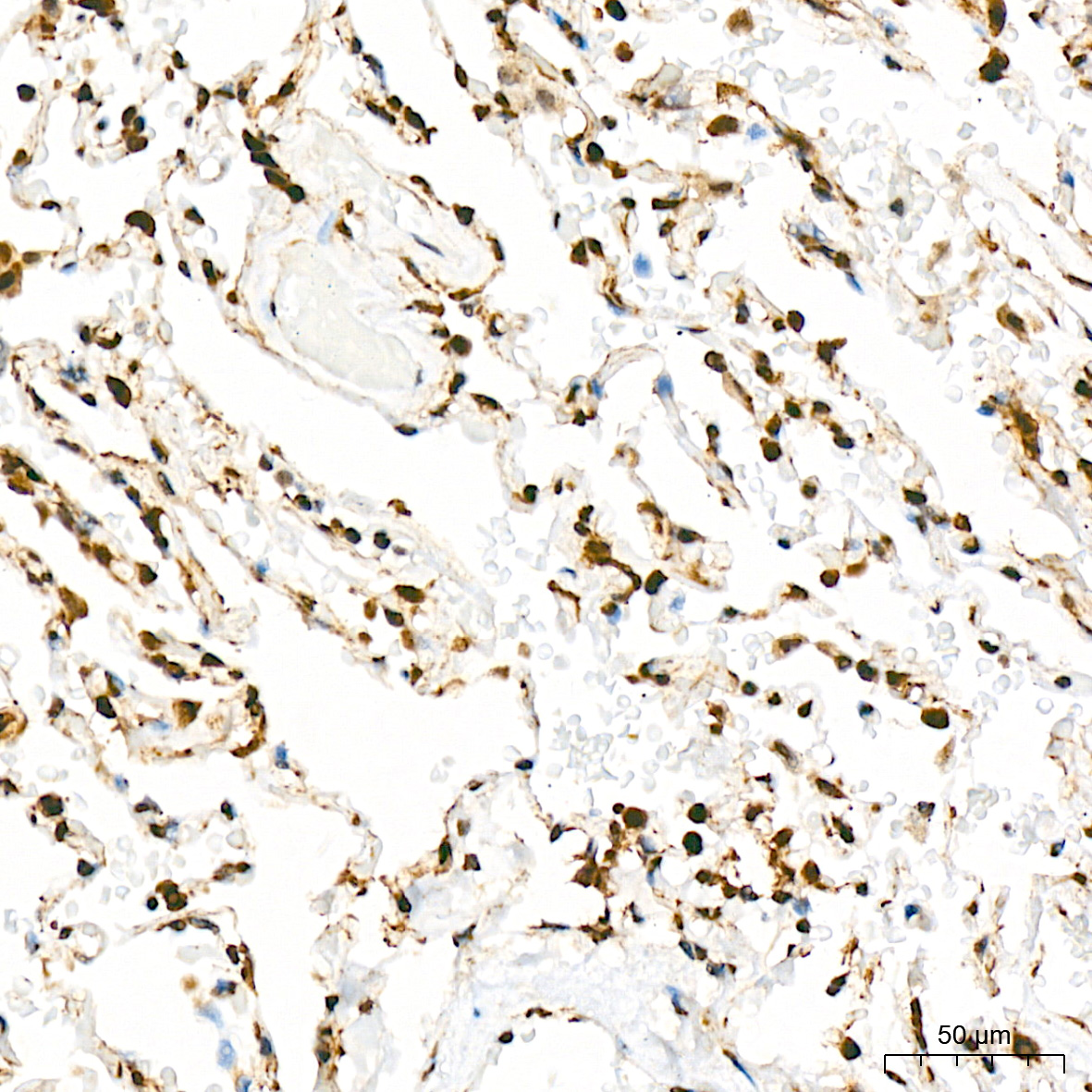 CIRBP Antibody (3V9S7)