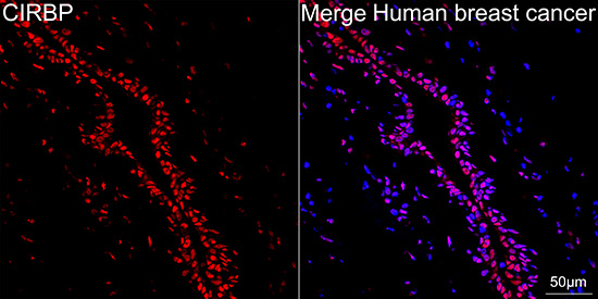 CIRBP Antibody (3V9S7)