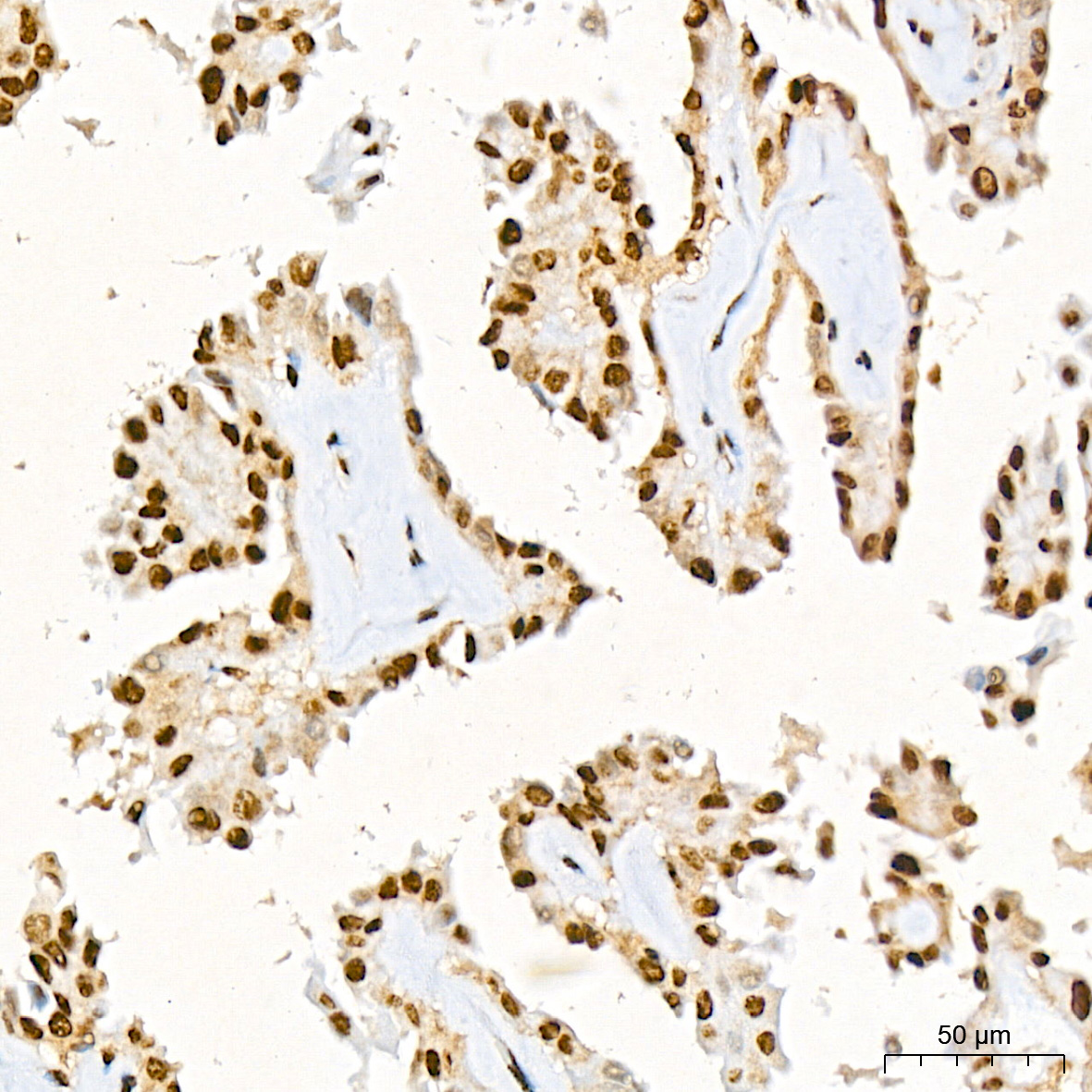 CIRBP Antibody (3V9S7)