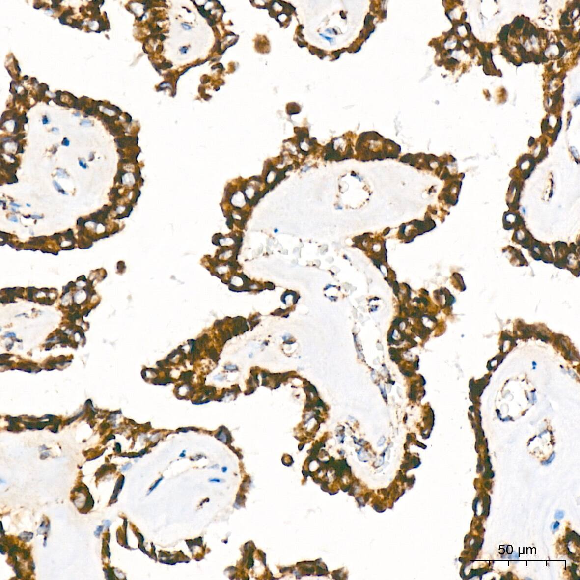 Bcl G Antibody (6R9F3)