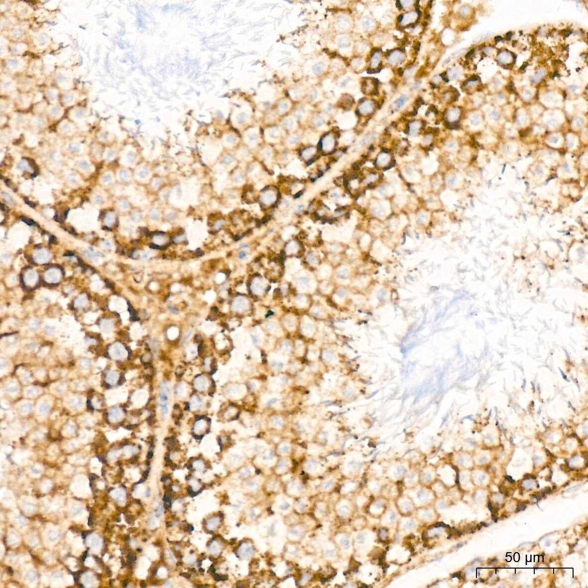 Bcl G Antibody (6R9F3)