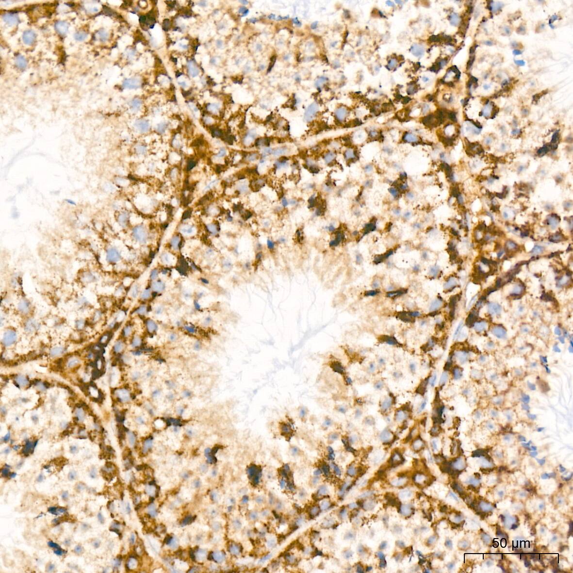 Bcl G Antibody (6R9F3)