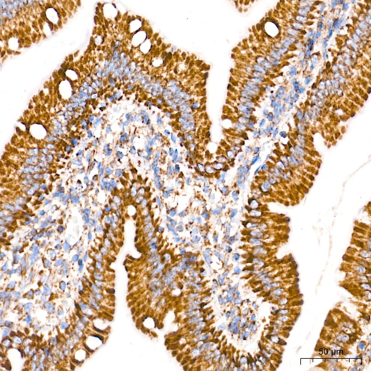 TOMM20 Antibody (10G6I8)