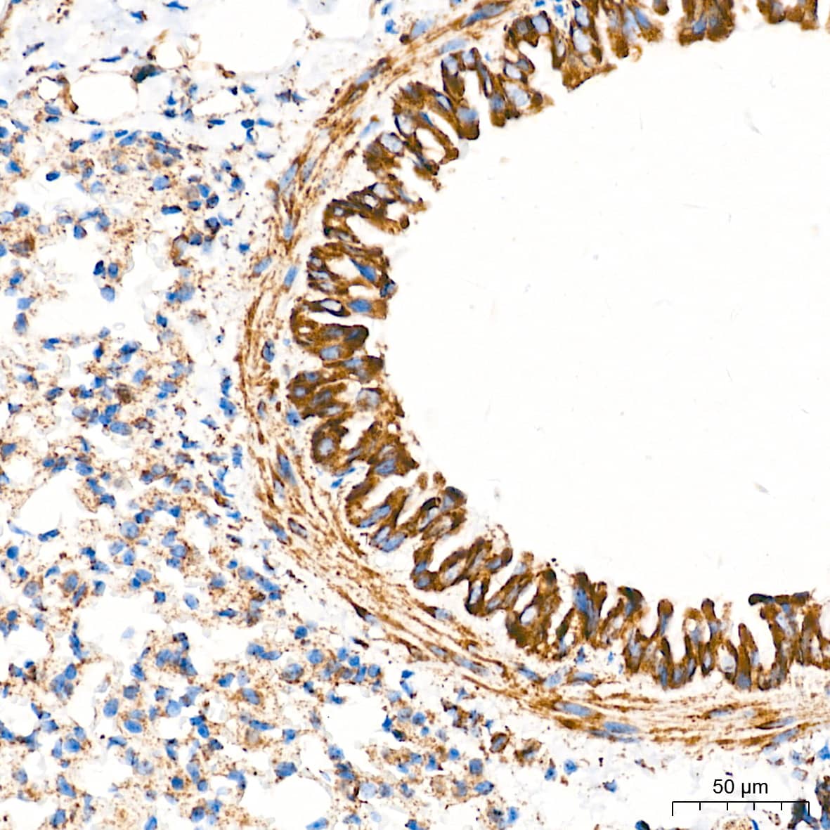 TOMM20 Antibody (10G6I8)