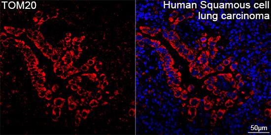 TOMM20 Antibody (10G6I8)