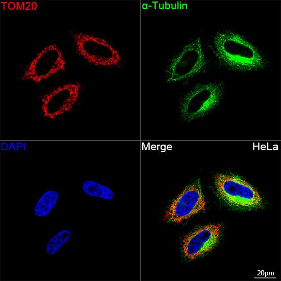 TOMM20 Antibody (10G6I8)