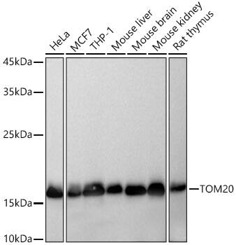 TOMM20 Antibody (10G6I8)