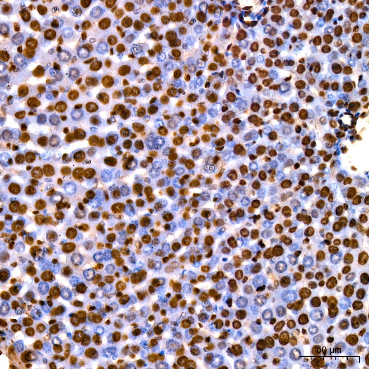 HMGB1/HMG-1 Antibody (1C4T5)