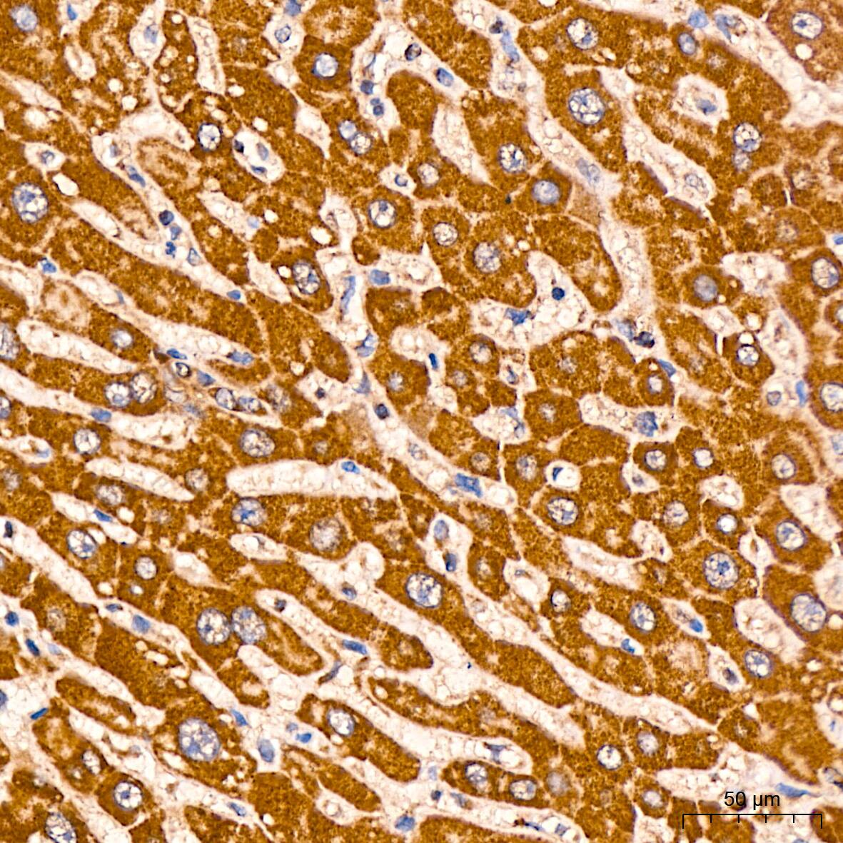 Prohibitin Antibody (0V2R10)