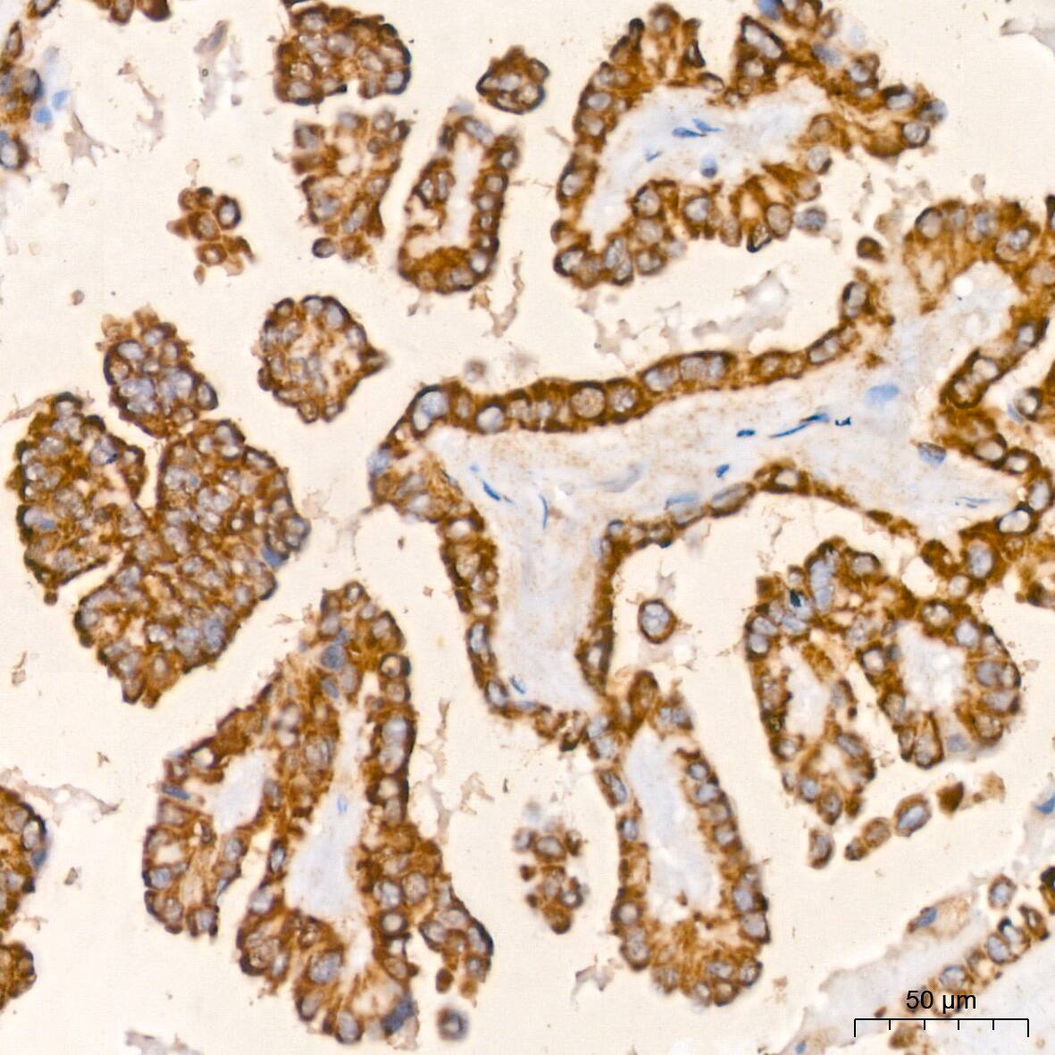 Prohibitin Antibody (0V2R10)