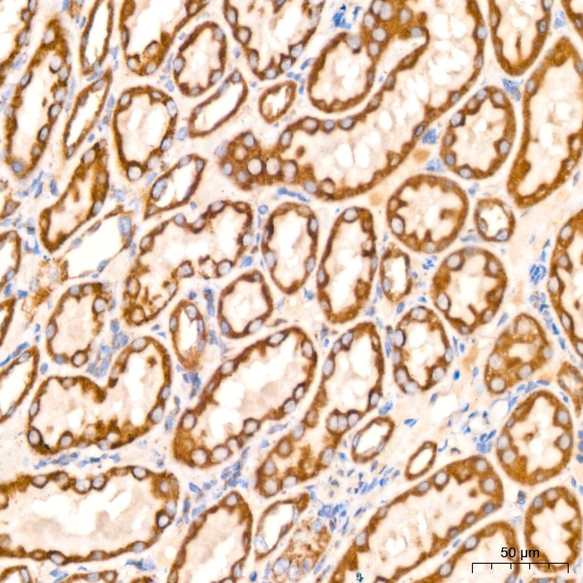 Prohibitin Antibody (0V2R10)