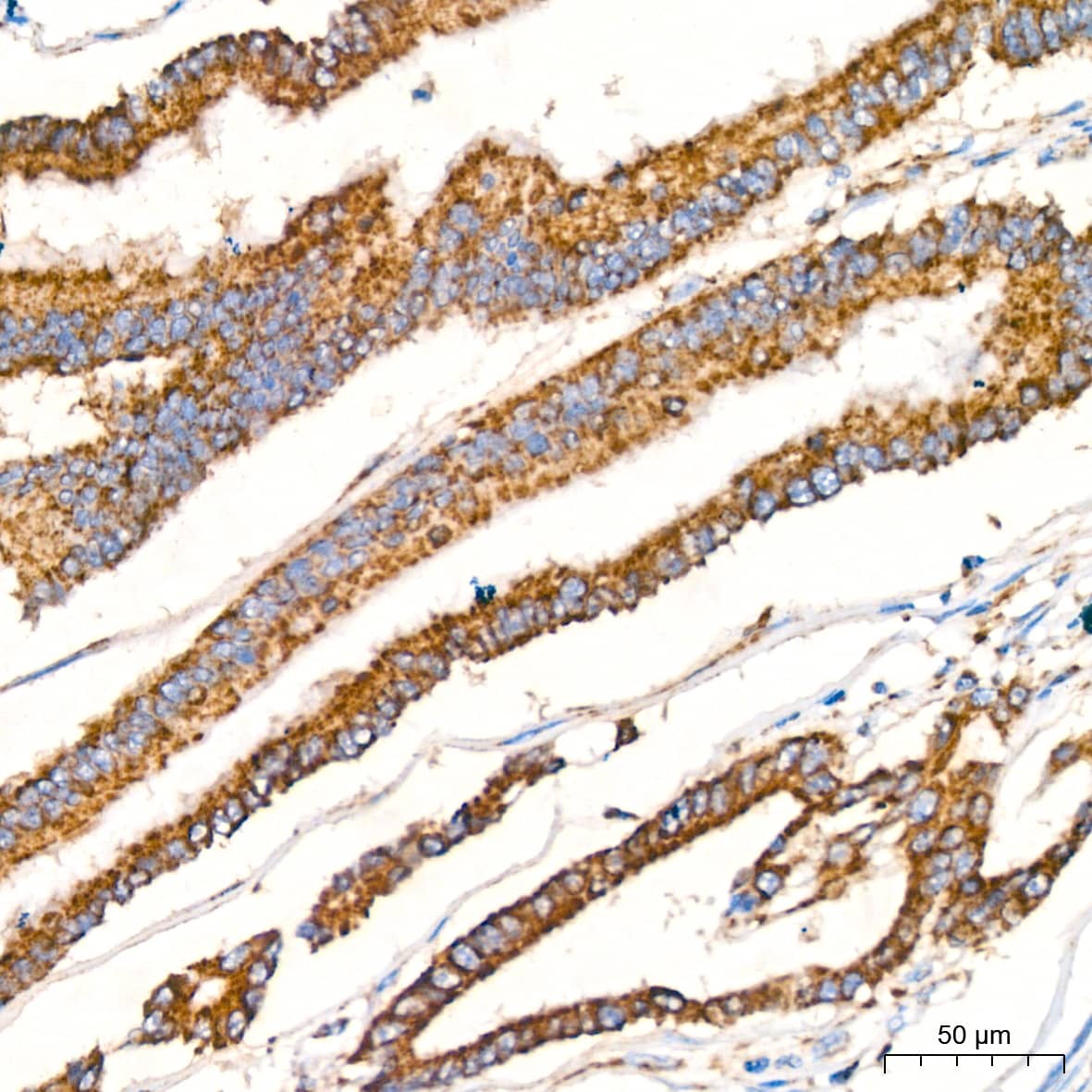 Prohibitin Antibody (0V2R10)