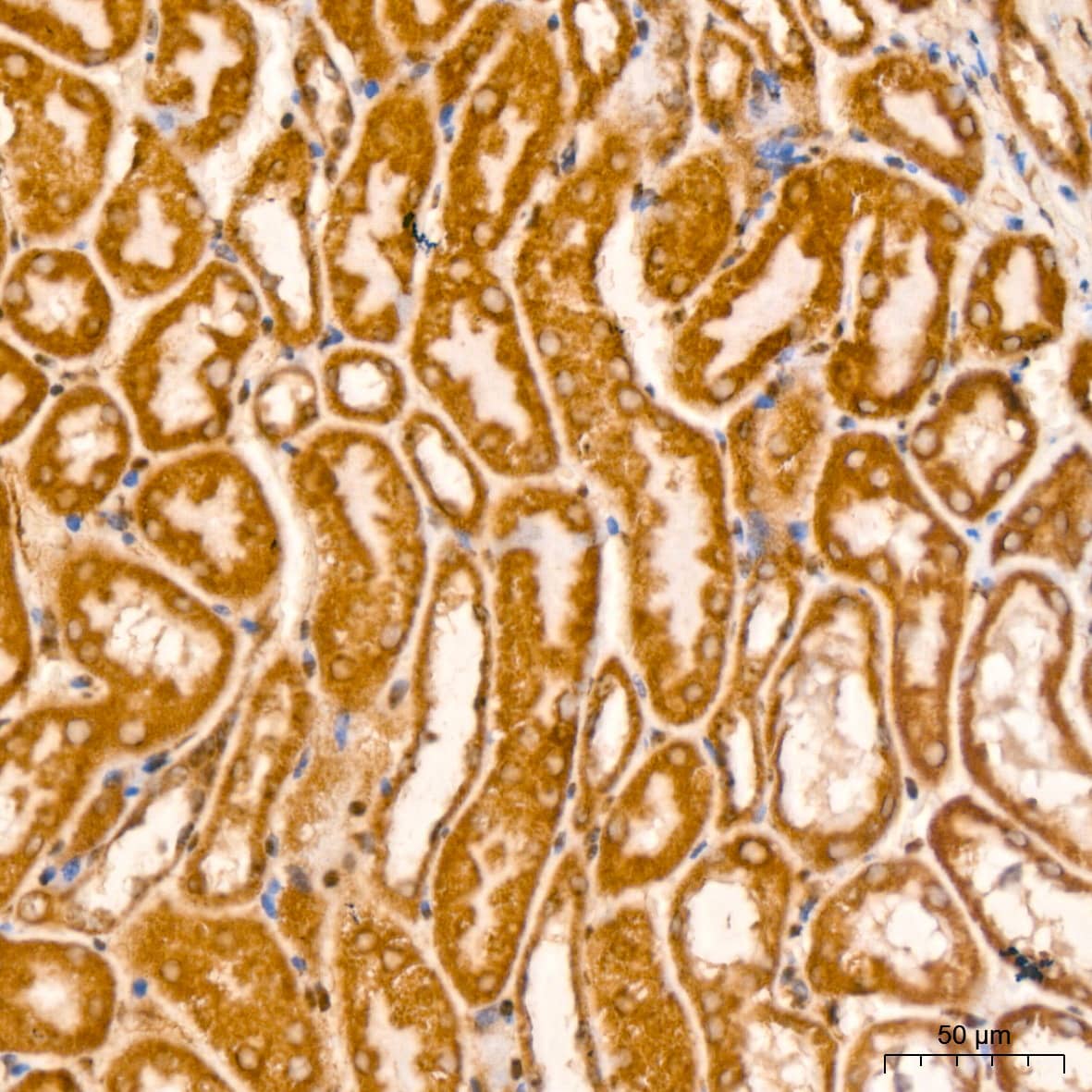 Prohibitin Antibody (0V2R10)