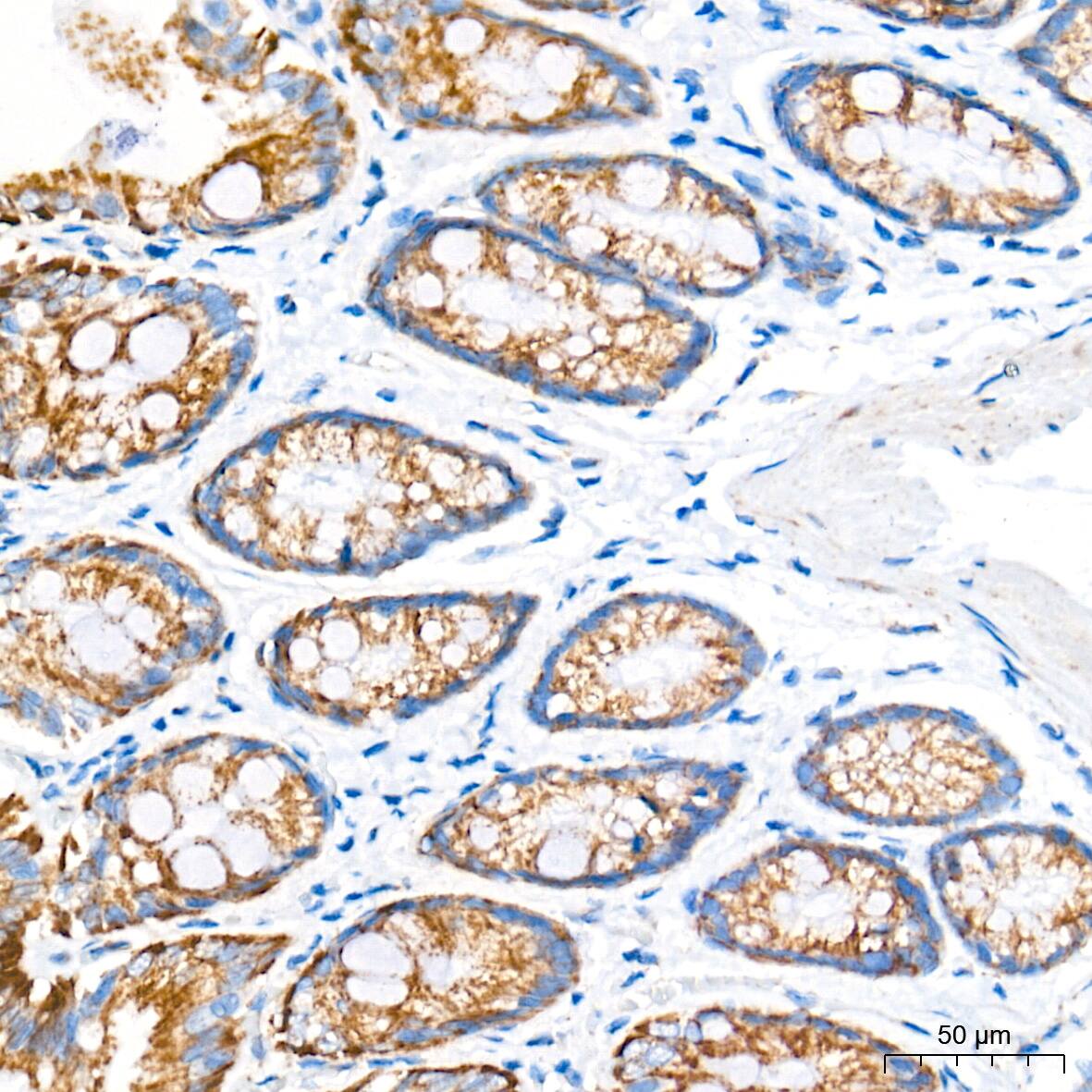 AIF Antibody (5F0Y1)