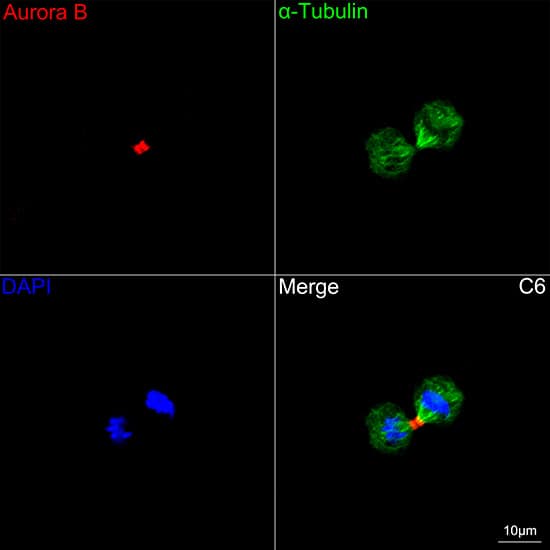 Aurora B Antibody (3C4V8)