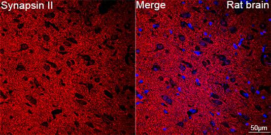 Synapsin II Antibody (7J6L0)