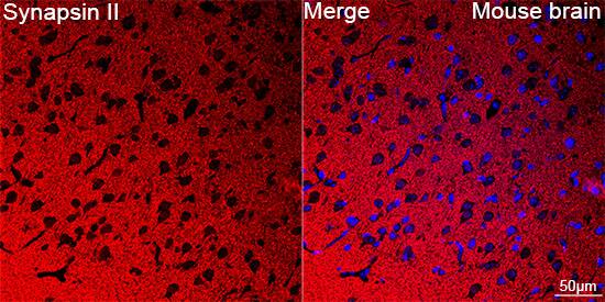Synapsin II Antibody (7J6L0)