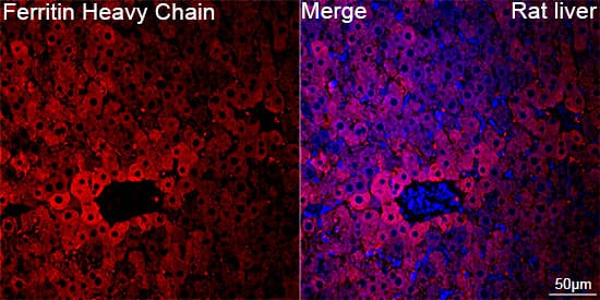 Ferritin Heavy Chain Antibody (1Q10I7)