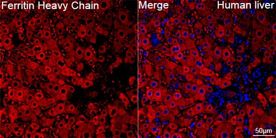 Ferritin Heavy Chain Antibody (1Q10I7)